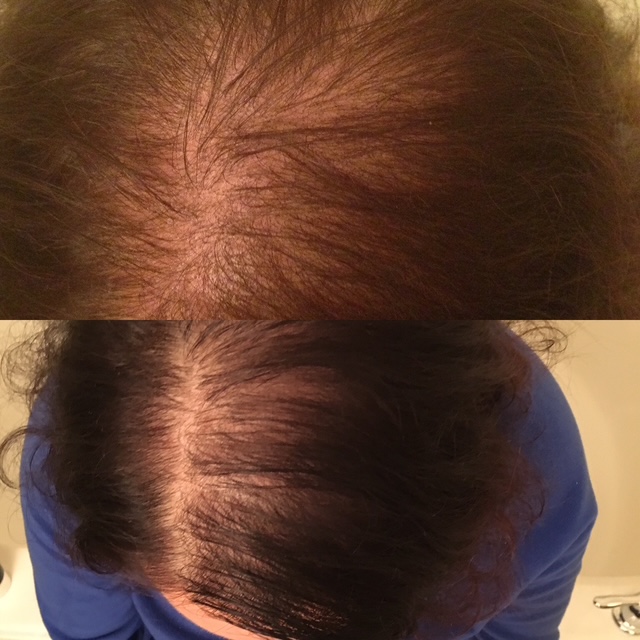 before & 5 months later