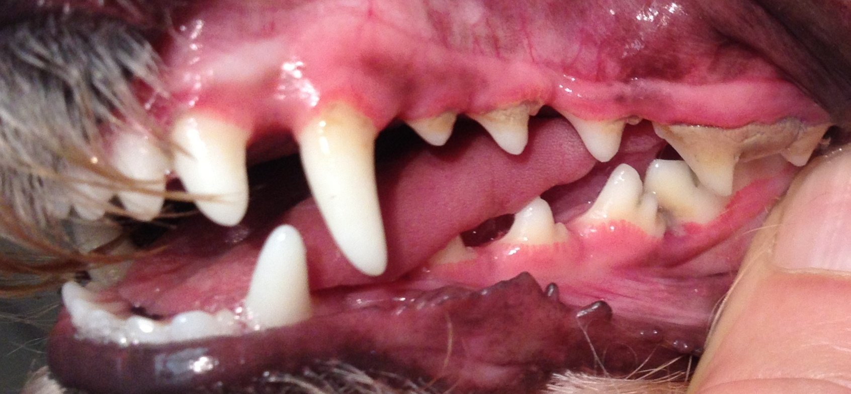 A common area of crowding. Note the increased gingivitis and calculus on molar as a result.