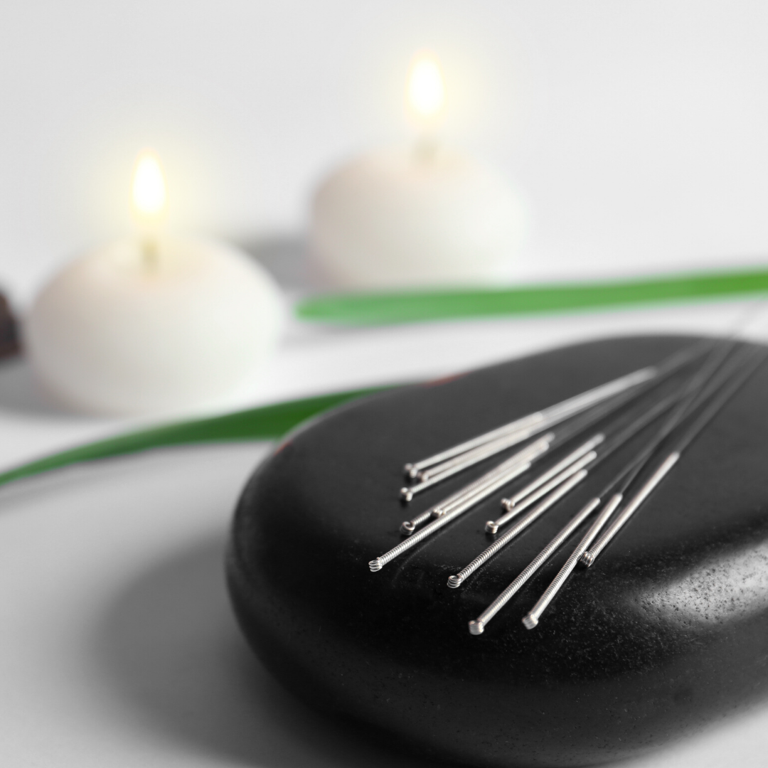 Acupuncture needles in spa setting