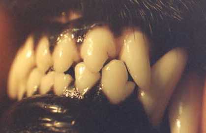 "Almost" normal but notice the contact of tooth to tooth, eventually will wear away enamel.