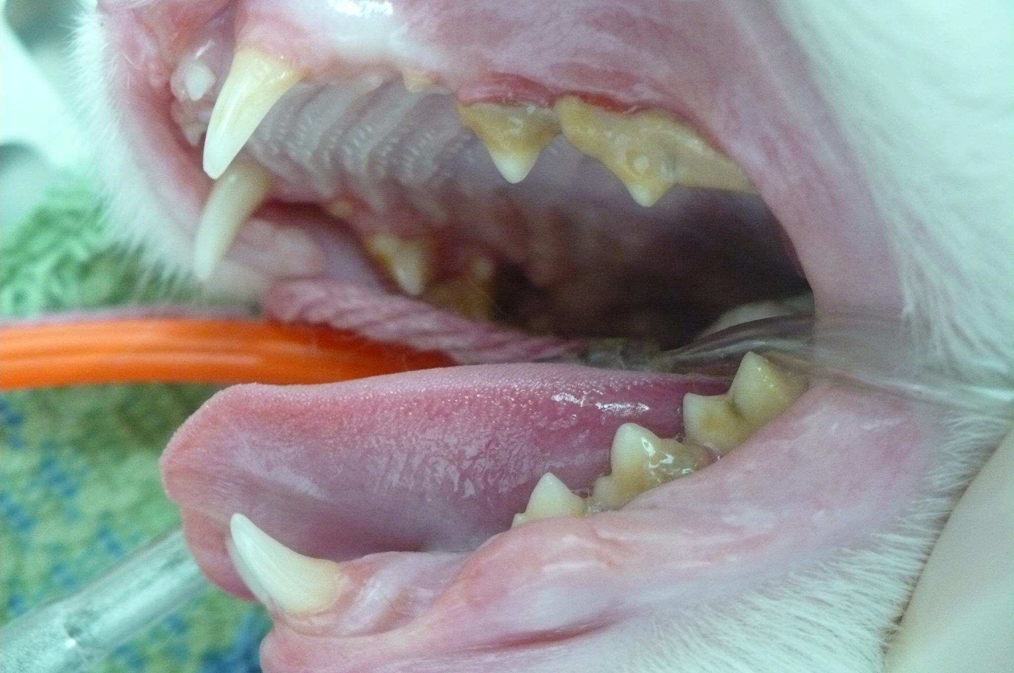 Notice the red and swollen gums under the calculus.