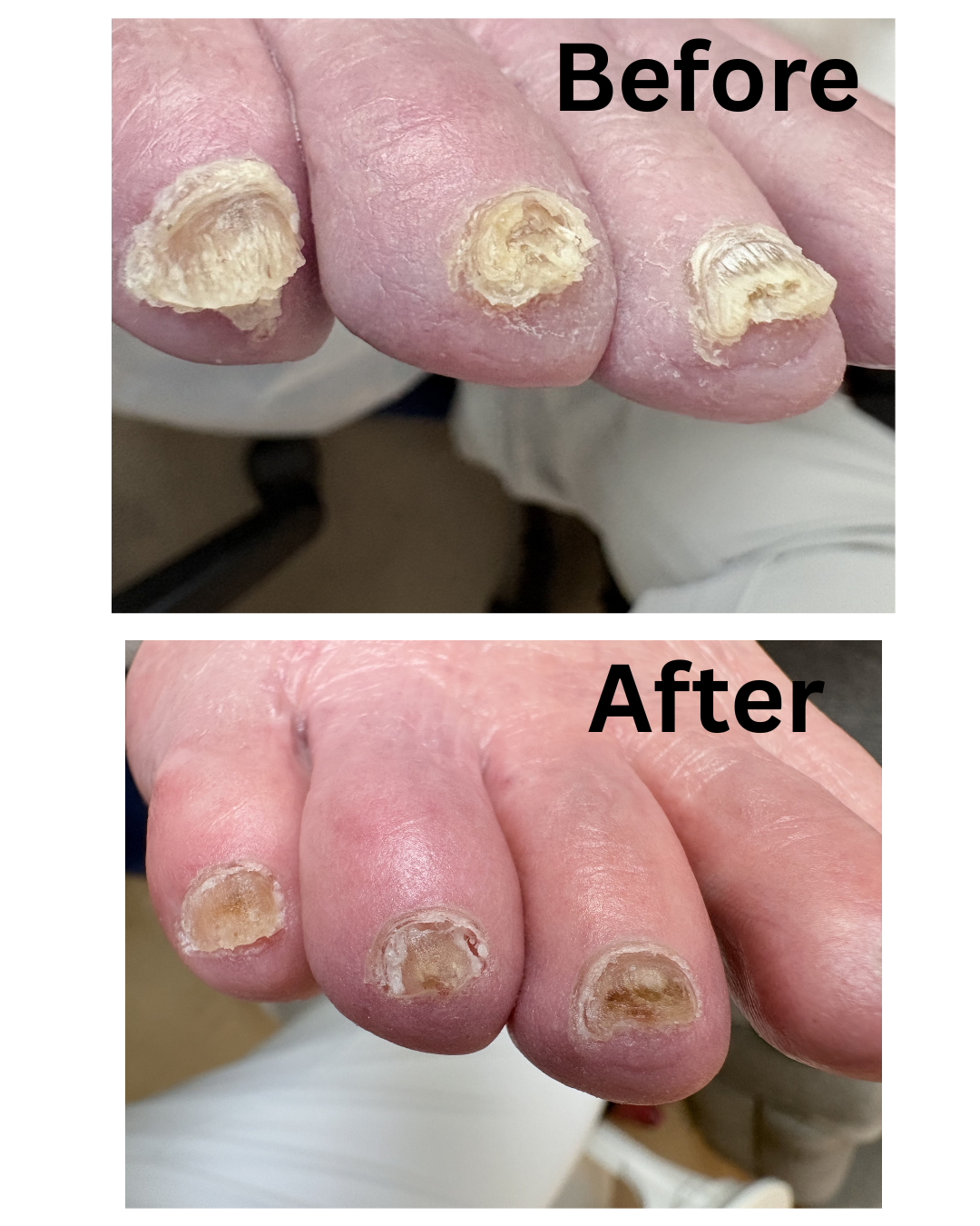 https://0901.nccdn.net/4_2/000/000/01e/76f/before.png