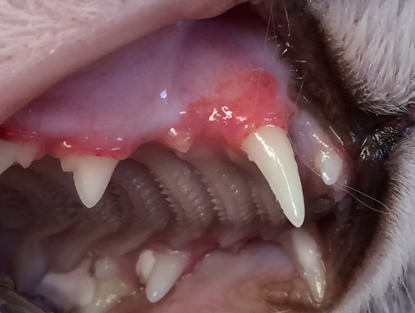 This is more redness than expected for just gingivitis, likely a resorbtive lesion.