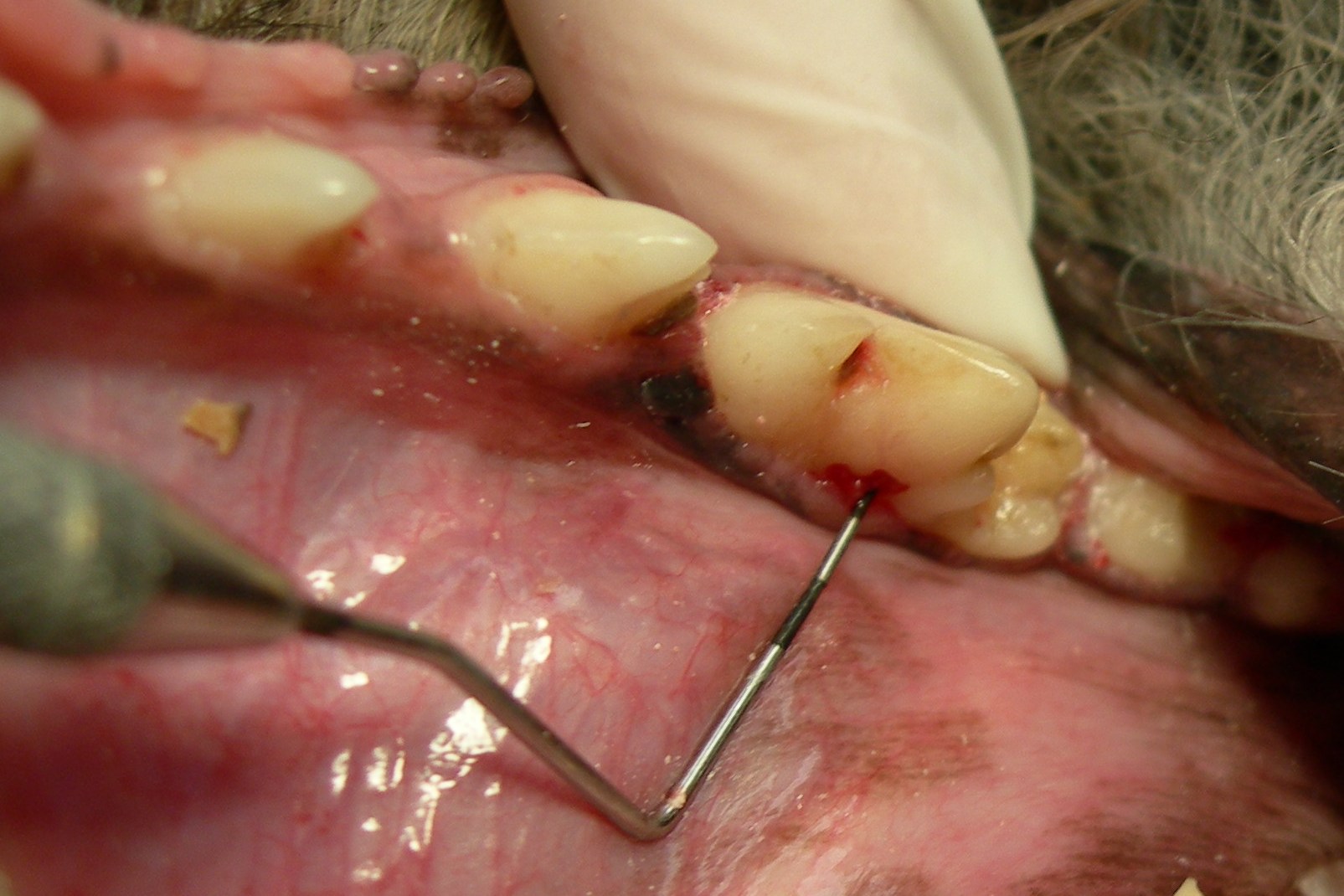 Rare finding, a cavity on a molar