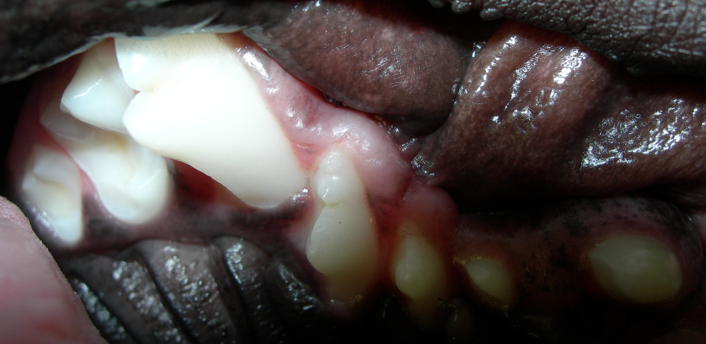 See the contact between the larger and smaller tooth? Both with be lost if nothing is done.