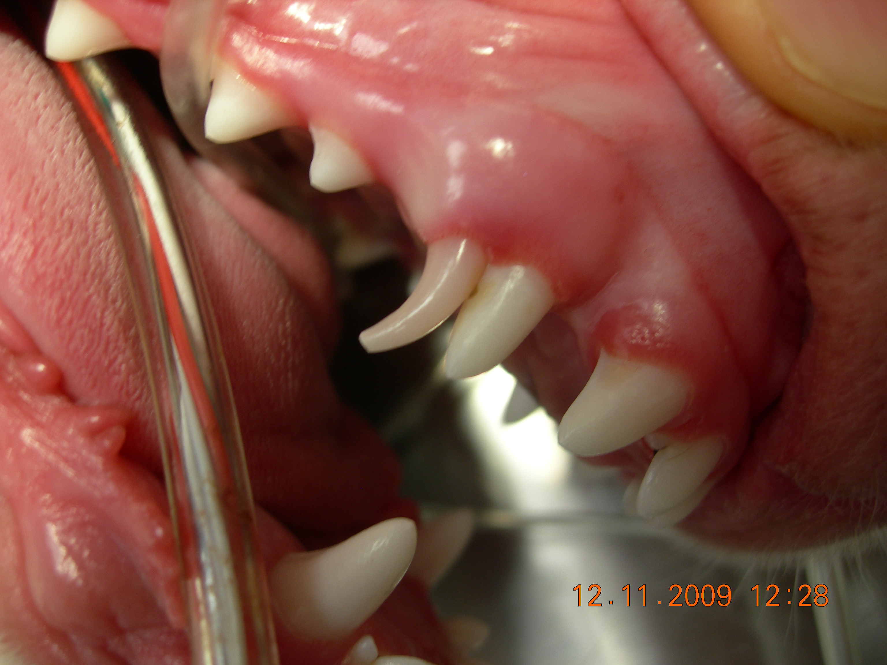 Baby tooth behind adult. Before extraction. Note wear on tip of baby tooth
