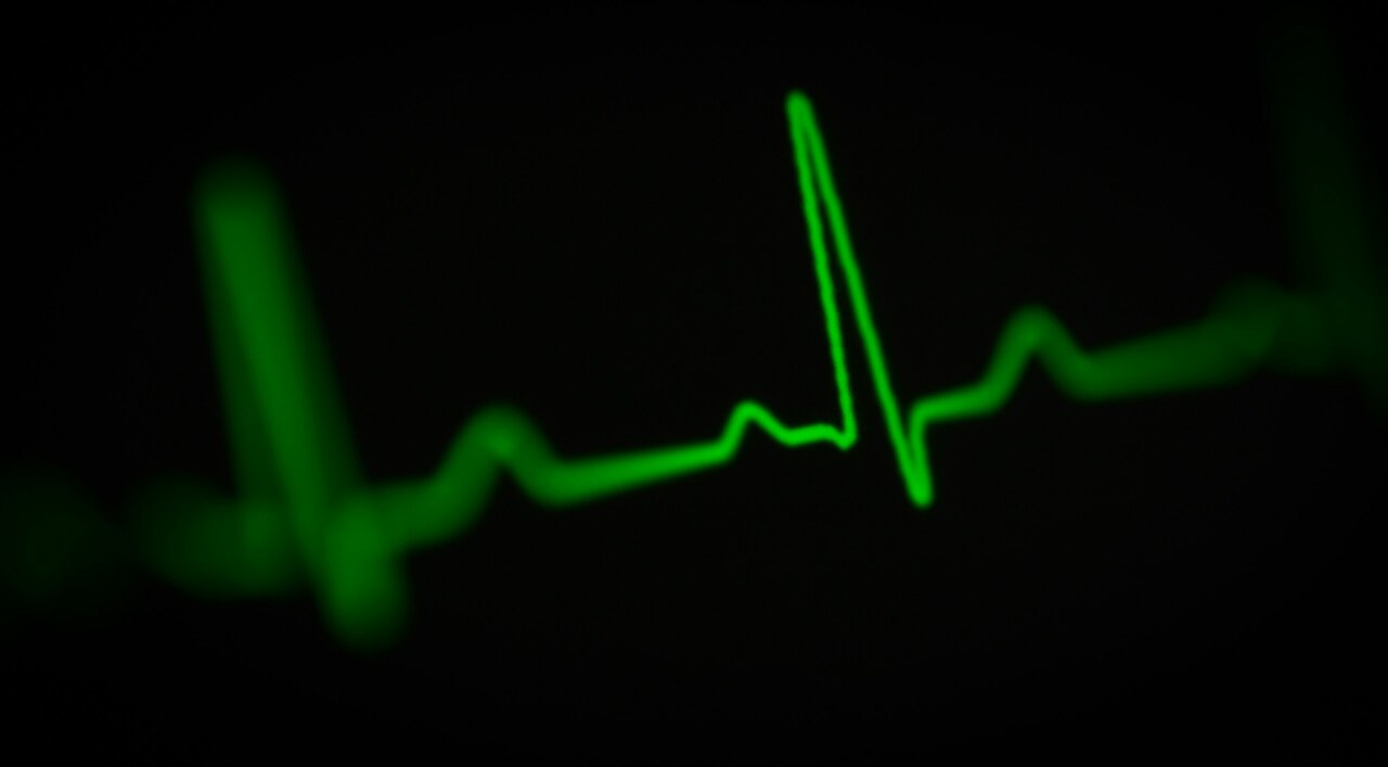 Green electrocardiogram heart rate monitor line on a black background.