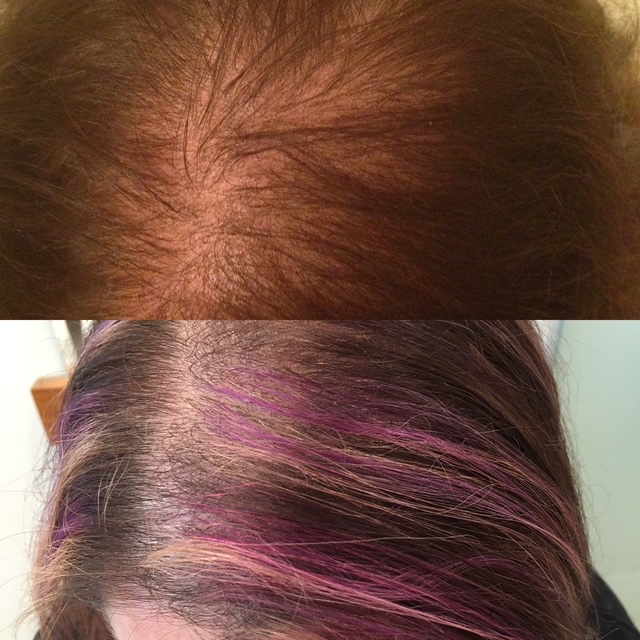 before & 2 years later