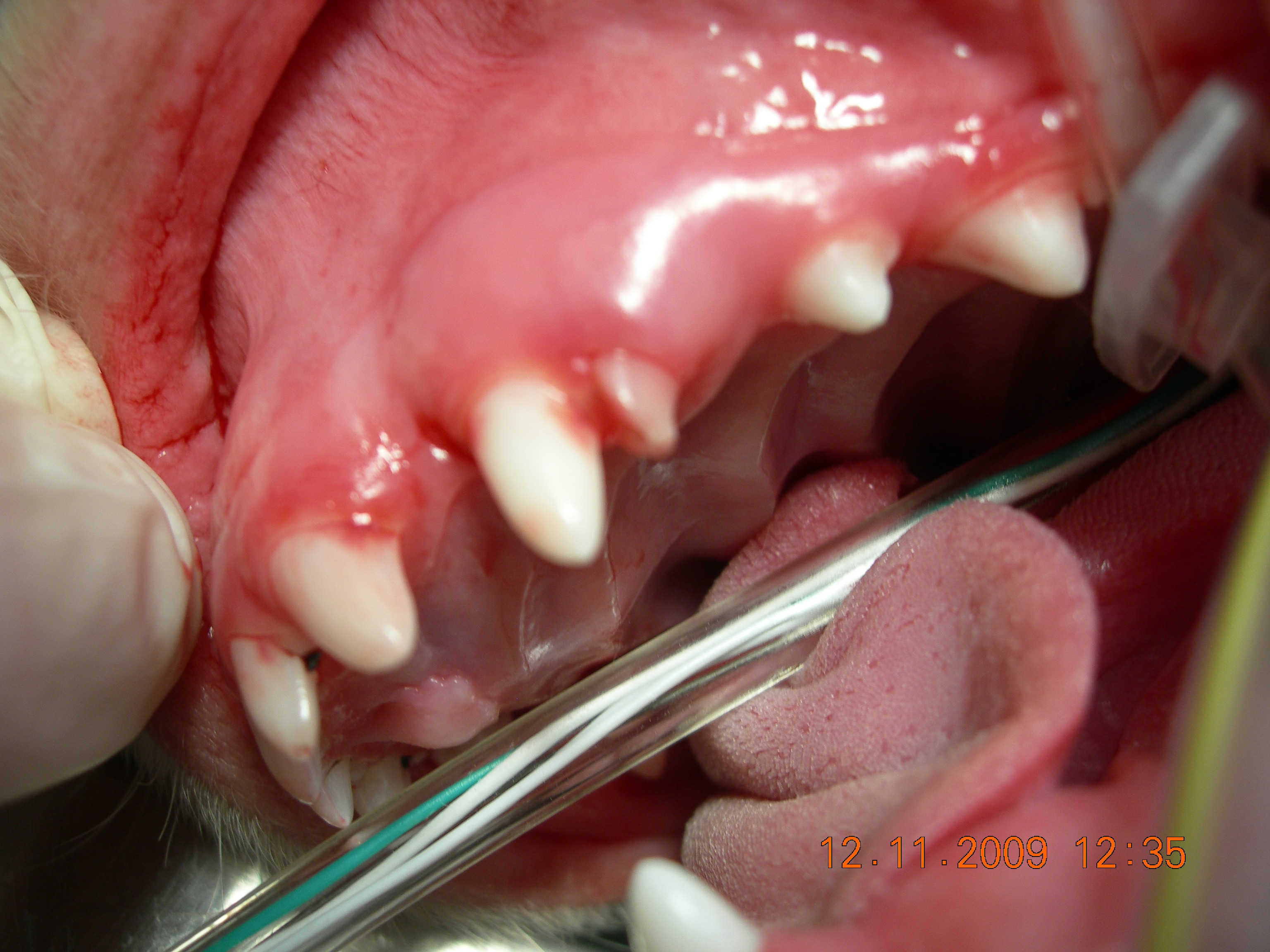 Retained baby tooth broken off